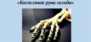 [Голод] Жара, вооруженный конфликт и запреты на экспорт: глобальные продовольственные угрозы растут, миру грозит продовольственный кризис не только из-за зерновой сделки