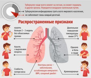 Минздрав сообщил о снижении смертности от туберкулеза в РФ в шесть раз за 20 лет, а заболеваемости - в три раза