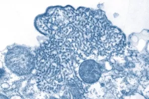 Роспотребнадзор: угроза эпидемии вируса Нипах в России отсутствует