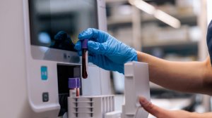 Российские учёные создают методы лечения рака без химиотерапии