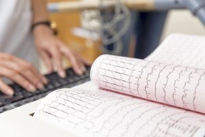 Люди моложе 40 лет все чаще умирают от инфаркта