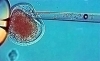 Ученым удалось произвести клонированный эмбрион из клеток кожи