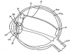 Исследователи научились вставлять в глаз камеру
